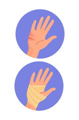 Types of bandages set. Swathe for cure palm. Health care and treatment, medicine. Cut and wound. Medical infographics. Cartoon flat vector collection isolated on white background