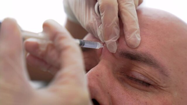 Beautician doctor makes botox injection in temporal head part of adult bold man. Professional cosmetologist doing injection with botox for rejuvenation face skin.