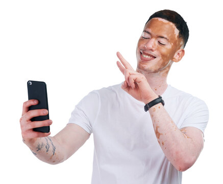 Happy man, face and peace sign with vitiligo for selfie or photography isolated on a transparent PNG background. Male person or model smile with skin pigmentation for photograph, picture or capture