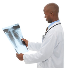 Xray scan, doctor or black man check lung cancer risk, clinic research or MRI for medical...
