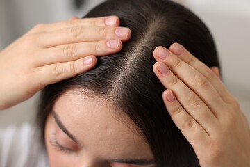 Naklejka premium Woman examining her hair and scalp on blurred background, closeup