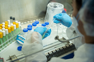 tuberculosis Department samples in the lab
