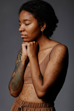 Young woman with acne scars and tattoo standing against gray background