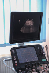 Ultrasound machine in medical office on blue curtains background pregnancy hospital