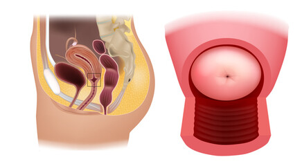  Cervix uteri anatomy. The cervix is the lower narrower portion of the uterus. Diagram of the uterus and part of the vagina. The human female reproductive system.