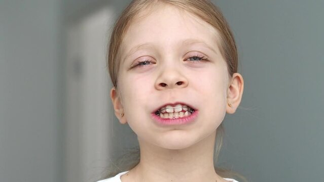 Correcting a girl's bite using a removable orthodontic appliance. A child smiles widely with a plate in his mouth, Functional devices for aligning the bite in the mouth, vertical video