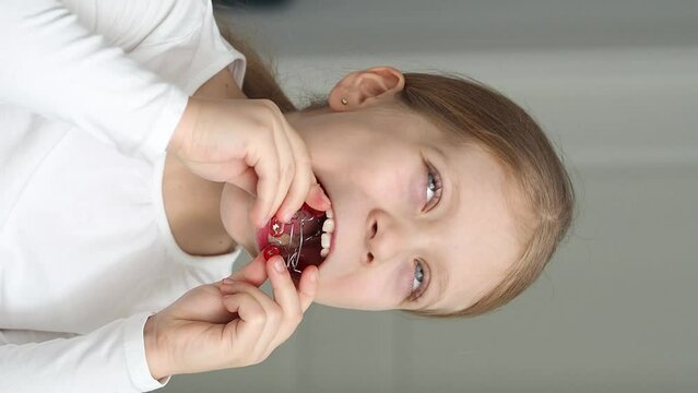 Functional devices for aligning the bite are installed in the mouth. The girl puts a plate in her mouth. plate for teeth. Removable plates and simple treatment.