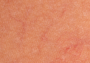 Close-up of veins on the skin. Macro - obrazy, fototapety, plakaty