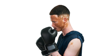 Man with vitiligo, profile and boxer for fight, self defense or training isolated on a transparent PNG background. Face of person, boxing or fighter with skin pigmentation or gloves in sport fitness