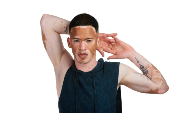 Man with vitiligo, portrait and stretching body in fitness standing isolated on a transparent PNG background. Active male person or athlete in warm up, stretch or getting ready for workout exercise