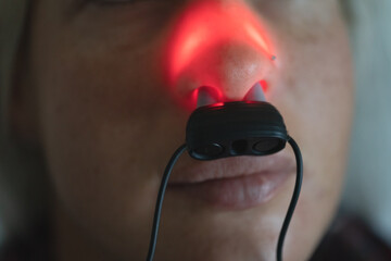 A girl treats her nose with a laser device for the nose, close-up photo.