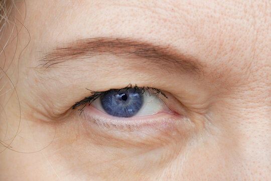 middle aged female's eye with drooping eyelid making eyebrow makeup. Ptosis is a drooping of the upper eyelid, lazy eye. Cosmetology and facial concept, first wrinkles