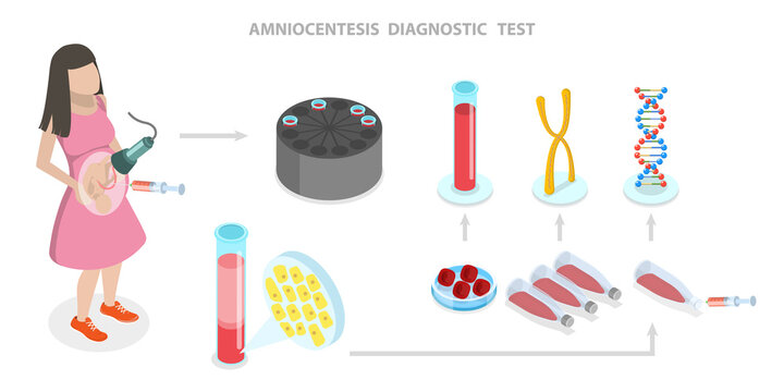 3D Isometric Flat  Illustration of Amniocentesis Diagnostic Test, DNA Gene Exam