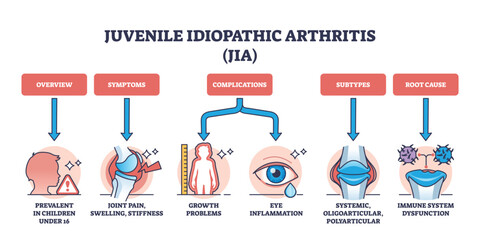 Juvenile idiopathic arthritis or JIA ad children disease outline diagram. Labeled educational scheme with medical condition for kids with joint pain, swelling and stiffness vector illustration. - obrazy, fototapety, plakaty