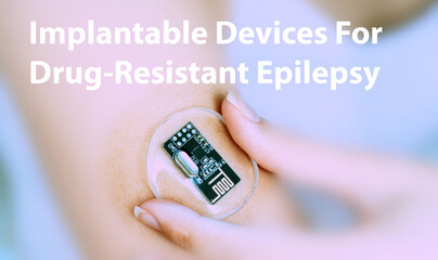 Implantable Devices For Drug-Resistant Epilepsy Implantable Electronic