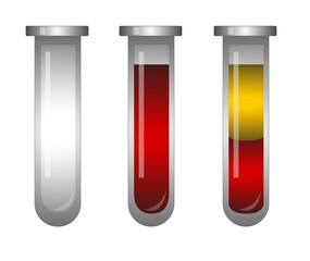 Set of glass medical test tube empty, filled with blood and fractionated in vitro blood, plasma and layers of red blood cells. Chemical glass in realistic style. Flat illustration. Blood analysis