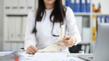 Orthopedic doctor explains physiology of bone model by pointing to point of model. Tell patient how to treat bone disease - obrazy, fototapety, plakaty