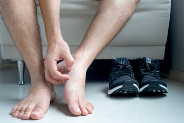 Men wear canvas shoes, he scratches legs and feet with itchy skin. Caused by of shoes