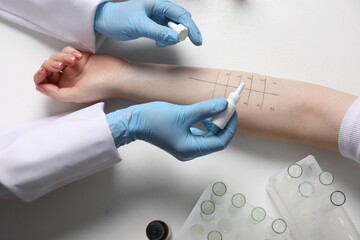 Doctor doing skin allergy test at light table, top view - obrazy, fototapety, plakaty