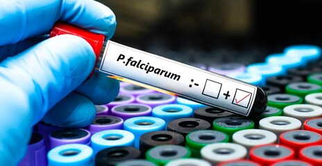 Fototapeta premium Blood sample of malaria patient positive tested for plasmodium falciparum.