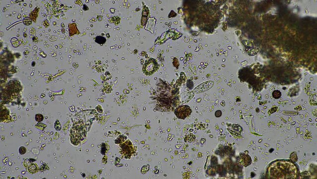 soil microorganisms under the microscope, including, fungi hyphae