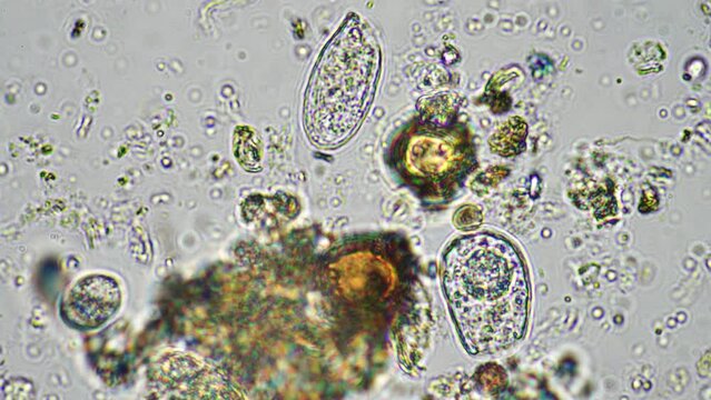 flagellates and amoeba protozoa soil microorganisms close up under the microscope. in a soil samlple from a farm