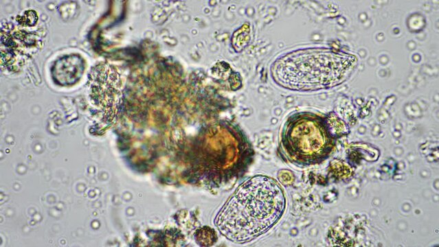 flagellates and amoeba protozoa soil microorganisms close up under the microscope. in a soil samlple from a farm