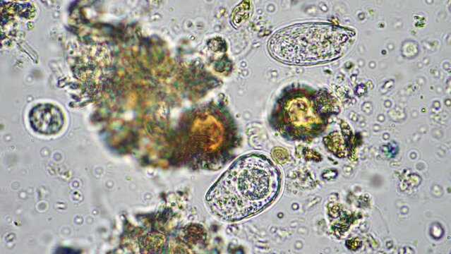 Microorganisms and biology in Compost and soil sample under the microscope in australia in a lab
