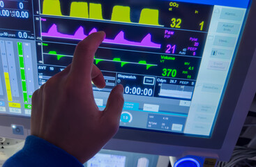 Hospital monitors display vital signs: hemodynamics, heart rate, blood pressure, temperature,...