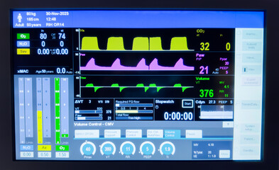 Hospital monitors display vital signs: hemodynamics, heart rate, blood pressure, temperature, oxygen saturation, and end-tidal CO2 for patient health assessment