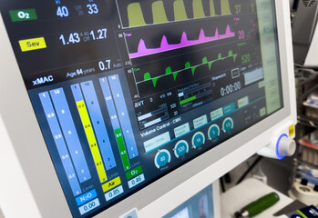Hospital monitors display vital signs: hemodynamics, heart rate, blood pressure, temperature,...