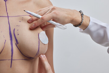 Doctor hand drawing lines on woman breast, breast implant surgery concept. - obrazy, fototapety, plakaty