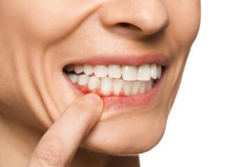 Obraz premium Woman showing inflamed gum on white background, closeup
