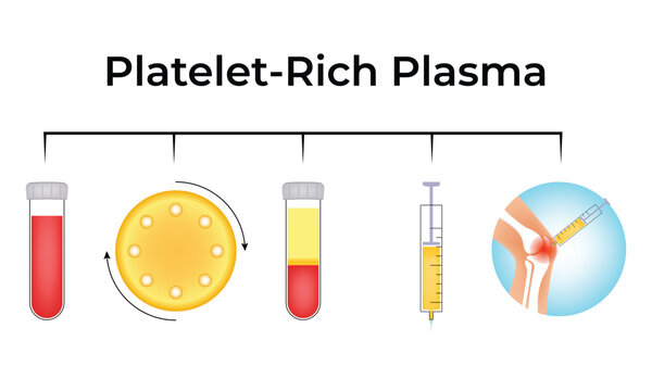 Platelet Rich Plasma Science Design Vector Illustration