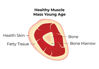 Muscle Loss in Sarcopenia Old Age Science Design Vector Illustration