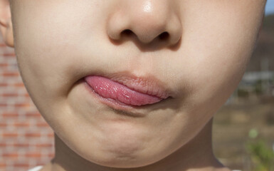 An Asian boy's crooked lips.