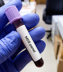 Blood sample for Myelodysplastic syndrome test. To diagnose MDS – a full blood count and a bone marrow biopsy. - obrazy, fototapety, plakaty