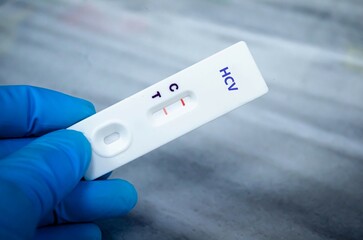 Blood sample of patient positive tested for anti-HCV by rapid diagnostic test.