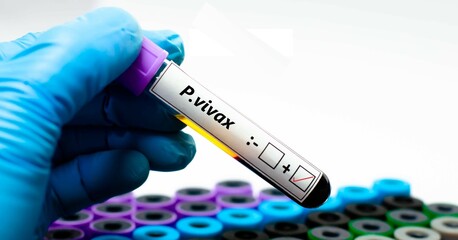 Blood sample of malaria patient positive tested for plasmodium vivax.
