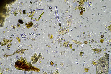 fungus and fungal hyphae in a soil sample on a farm, microorganisms and soil biology, fungi in the...