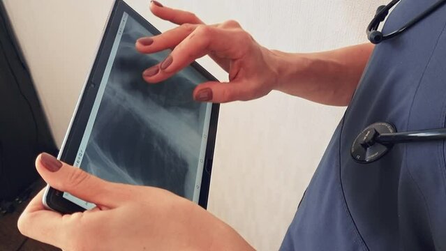 Slow motion footage of the female doctor in uniform against the white wall studying x-ray image of the lungs on the tablet. Healthcare