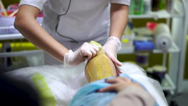 Removing a strip of yellow sugaring paste from the leg of a woman lying on a table in beauty salon. The accessibility and cheapness of hair depilation with wax. A master in white coat and gloves works