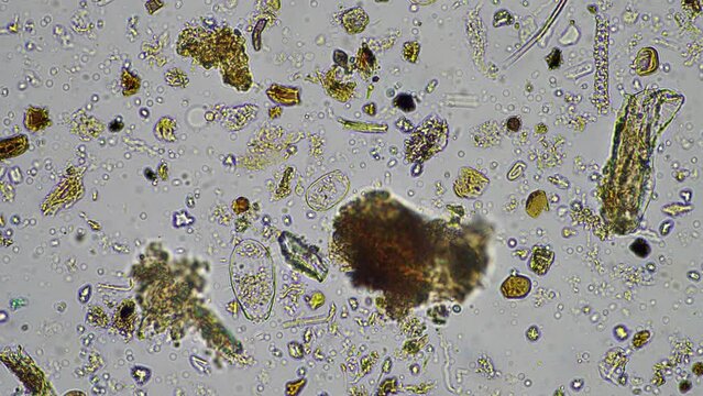 Soil microorganisms in a compost sample including bacteria, testate amoeba, flagellates. regenerative agricultural farm. Soil testing agriculture agronomy done for farmers for carbon sequestration
