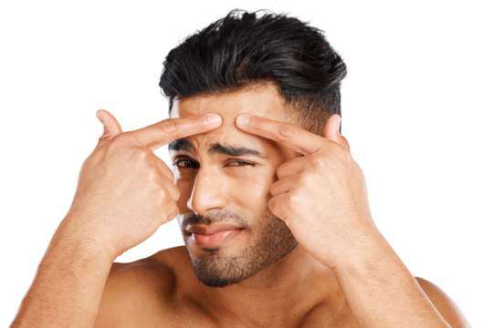 Man, portrait and squeeze acne on face for skincare, breakout and check blackhead isolated on transparent png background. Indian guy, facial beauty and press pimple with pain, stress and scratch scar