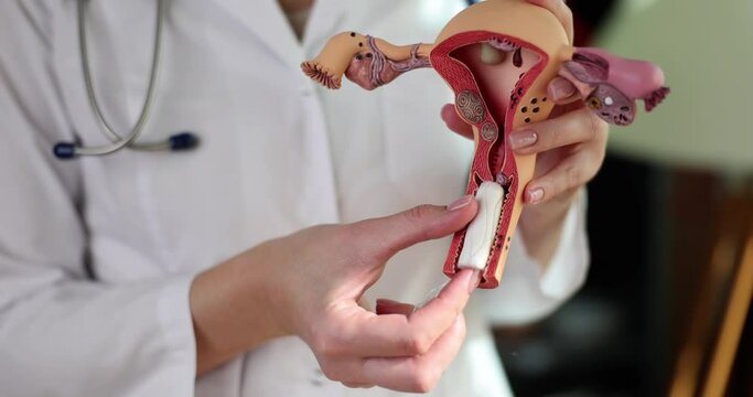 Doctor gynecologist inserting tampon into vagina on artificial model of uterus and ovaries closeup 4k movie slow motion. Hygiene products for menstruation concept