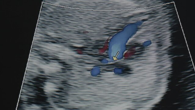 Ultrasound of the heart of an 20-week-old fetus in a mother's womb. 4K footage.
