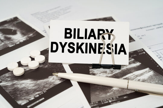 On the ultrasound pictures there is a pen and a business card with the inscription - Biliary dyskinesia
