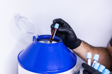 Close up of a medical worker puts a test tube with blood in a centrifuge to separate plasma from...