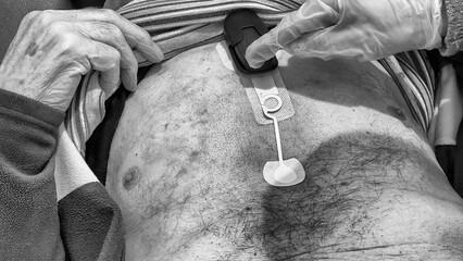 An elderly man in the hospital while having his Holter applied