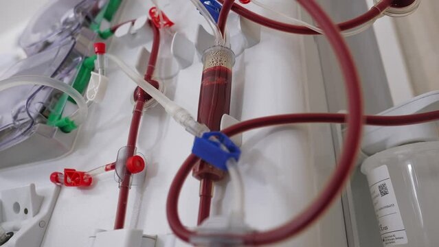 Hemodialysis bloodline tubes connected to hemodialysis machine. Health care, blood purification, kidney failure, transplantation. Part of a dialysis equipment during process of blood filtration.